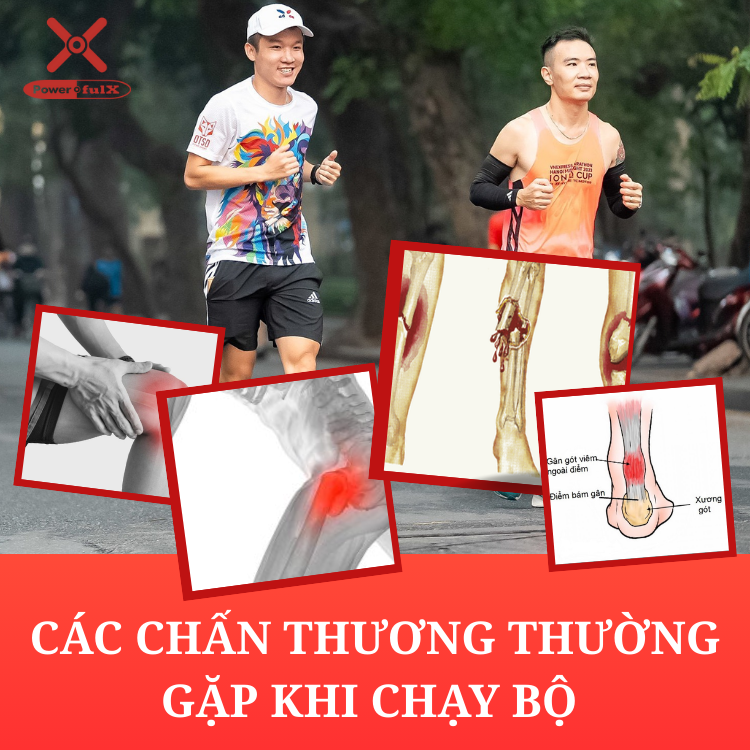 cac-chan-thuong-thuong-gap-khi-chay-bo-va-cach-phong-ngua