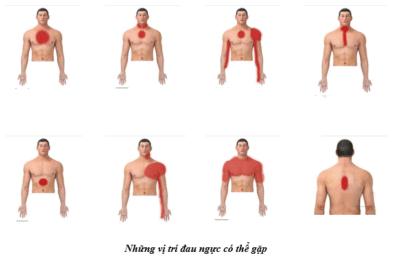 dau-co-nguc-khi-tap-gym-2