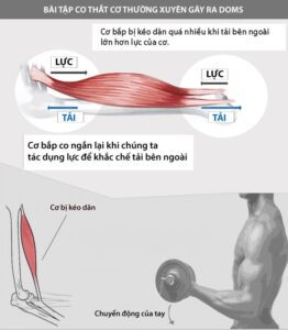 khi-bi-dau-co-co-nen-tap-tiep-1