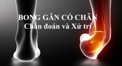 bong-gan-co-chan-5