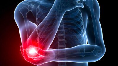 chan-thuong-khuyu-tay-khi-choi-pickleball-2