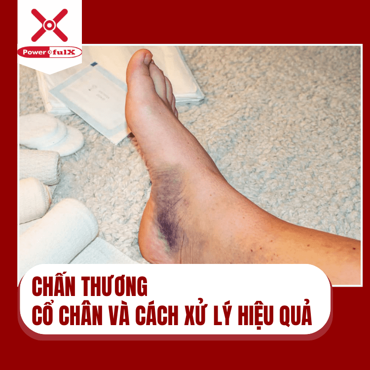 chan-thuong-co-chan-0