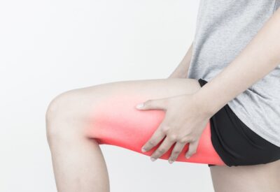 Tổng quan về đau cơ đùi: nguyên nhân, triệu chứng và cách xử lý 4 dau-co-dui-1